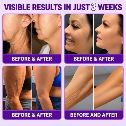 Nexisify® PDRN MULTI-ACTIVE COMPLEX Firming Body Cream